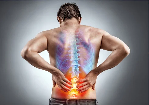 Back Pain